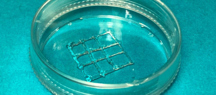 3D printing inside the body will help stomach ulcer patients