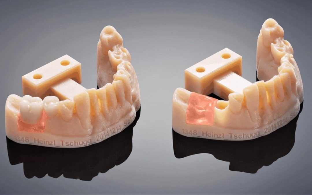 2020 Dental 3D Printing Guide: All You Need to Know