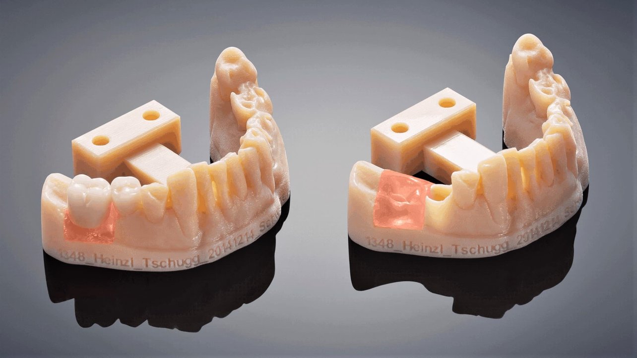 2020 Dental 3D Printing Guide: All You Need to Know