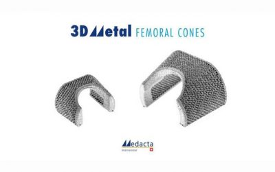 Medacta expands knee portfolio with 3DMetal femoral cones for knee revision