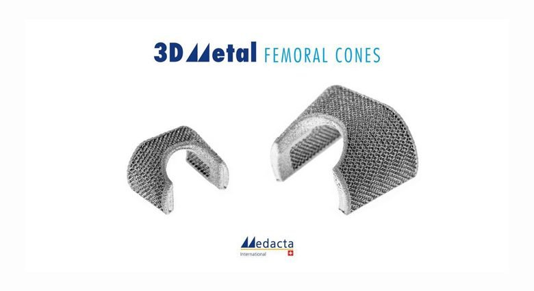 Medacta expands knee portfolio with 3DMetal femoral cones for knee revision