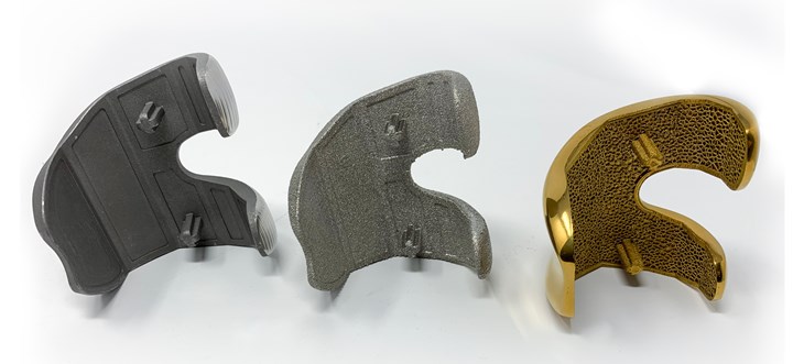 4 Ways 3D Printing Is Changing Medical Implants