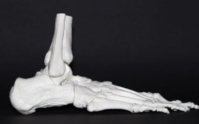 Zebra cleared to market 3D printing for orthopedic surgery