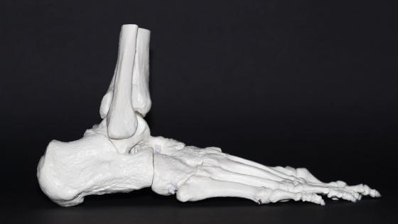 Zebra cleared to market 3D printing for orthopedic surgery