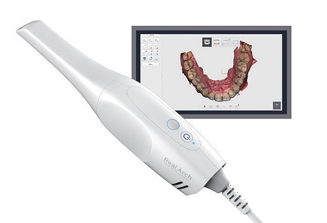 Digital Implant-related Patent Applications on the Rise