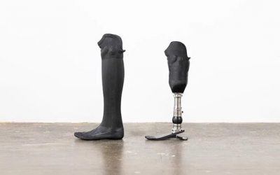 instalimb uses 3D scanning and printing to make prosthetic legs more affordable