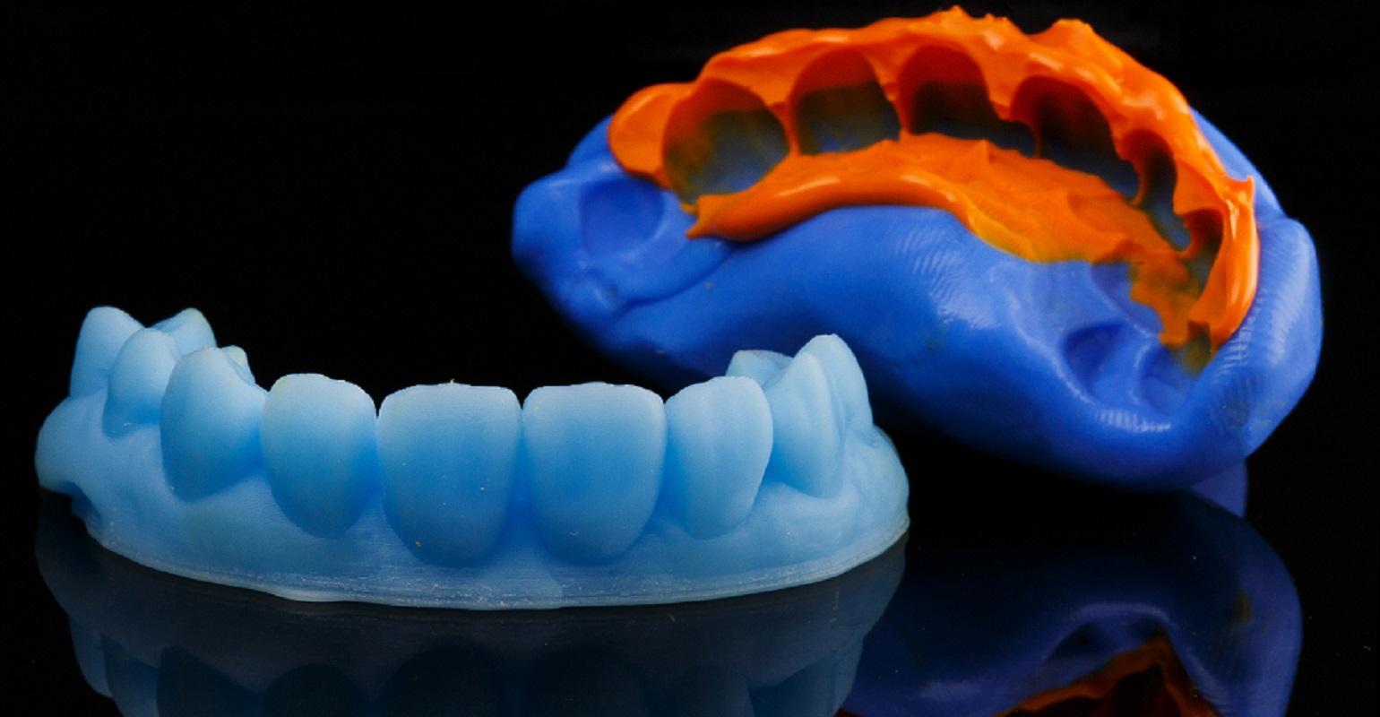 My Dentist Loves 3D Printing–It's Fast, Accurate, and Cheap