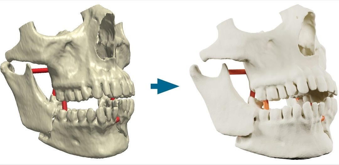 Simpleware ScanIP Medical Receives FDA 510(k) Clearance for 3D Medical Printing