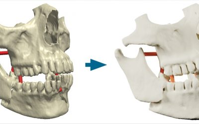 Simpleware ScanIP Medical Receives FDA 510(k) Clearance for 3D Medical Printing