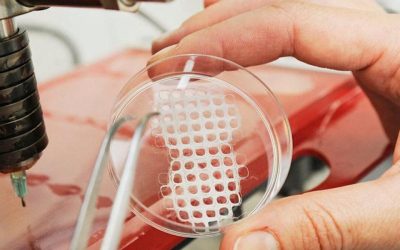 3D printers with “eyes and a brain” to advance body implants